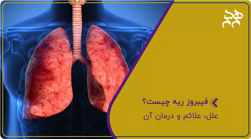فیبروز ریه چیست
